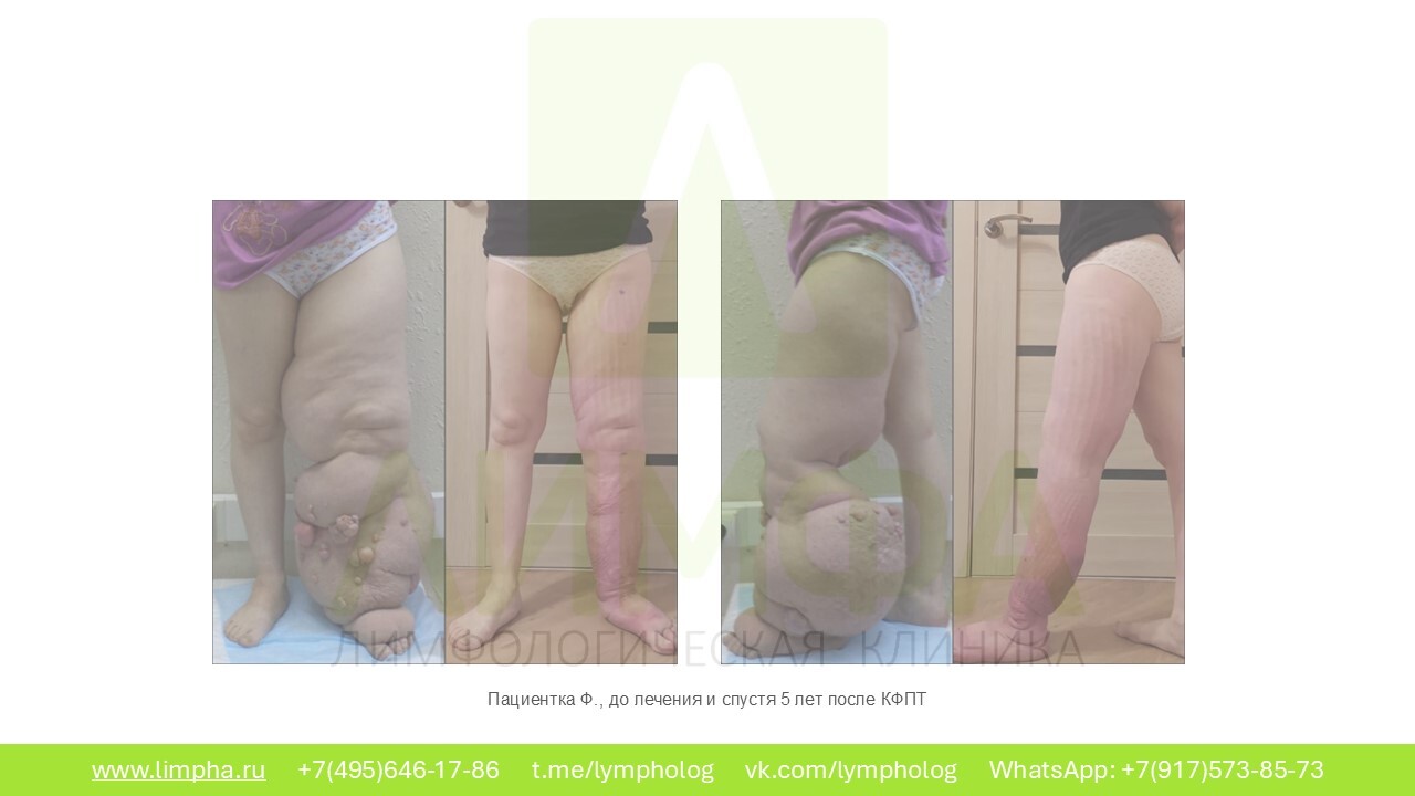 После лечения