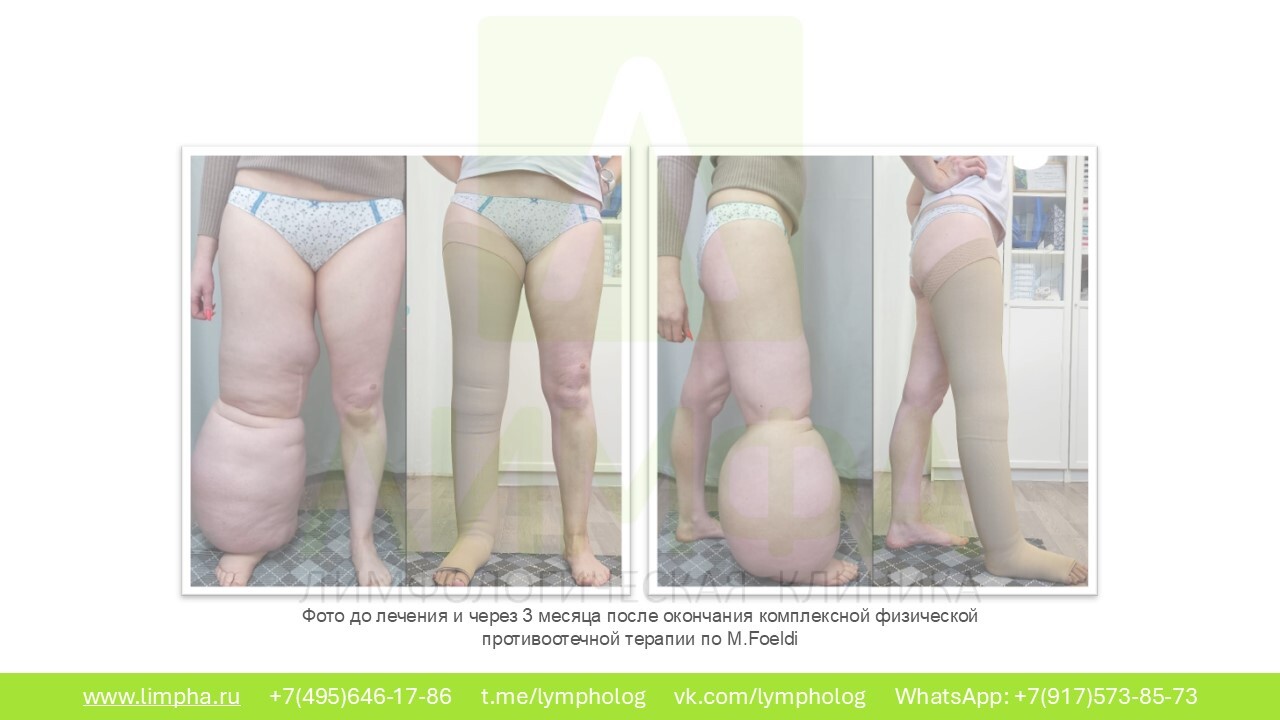 После лечения